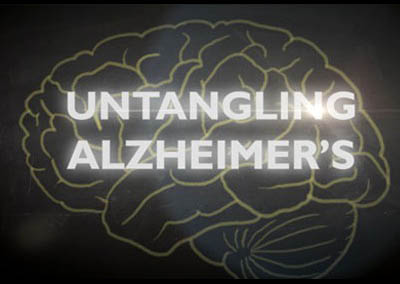 Untangling Alzheimer’s